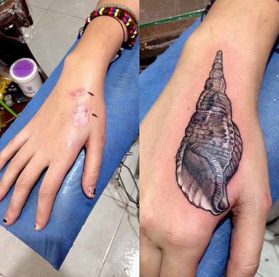 Tattoo Scar Cover-Ups
