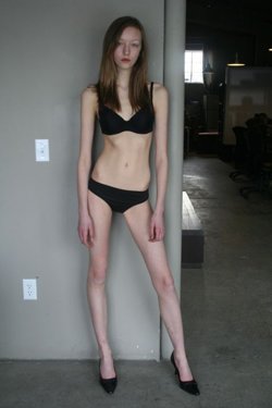 Starving for an Image - The Issue of Super Skinny Models